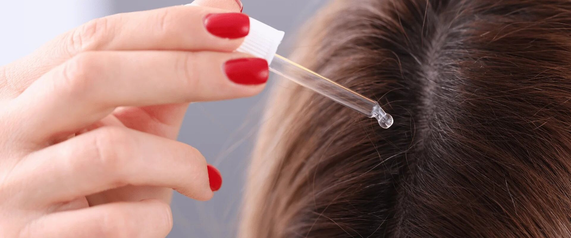 Миноксидил: что это такое, как он работает и кому он подходит