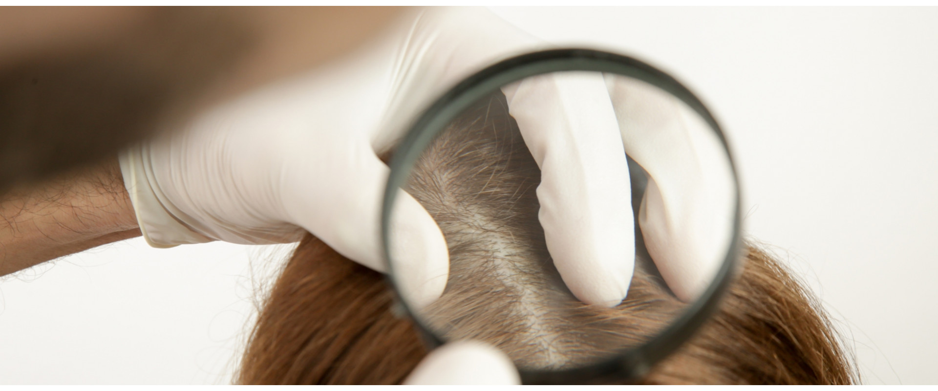 Чому більшість засобів від випадіння волосся не працює