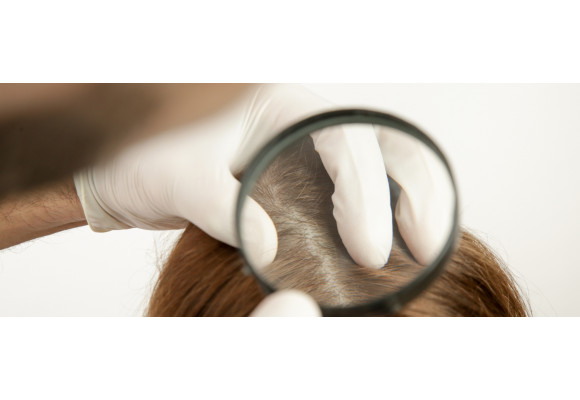 Почему большинство средств от выпадения волос не работает